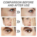 Sérum Facial Coreano Retinol Seoul 1988 – Clareador e Rejuvenescedor de Alta Performance