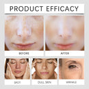 Sérum Facial com Ácido Hialurônico e Centella Asiática – Hidratação Profunda e Pele Iluminada